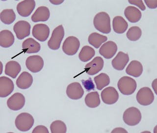 Trofozoítos intracelulares de Babesia felis (flechas)